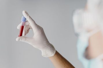 Informações sobre a suspensão dos exames de sangue em Agudos